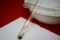 Zika: Cientistas brasileiros descobrem novo distúrbio.